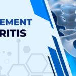 Hip Replacement for Arthritis Patients – Is It the Best Option