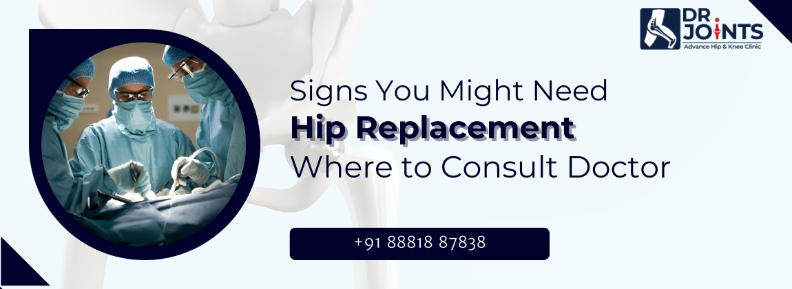 Signs You Might Need a Hip Replacement: When to Consult a Doctor