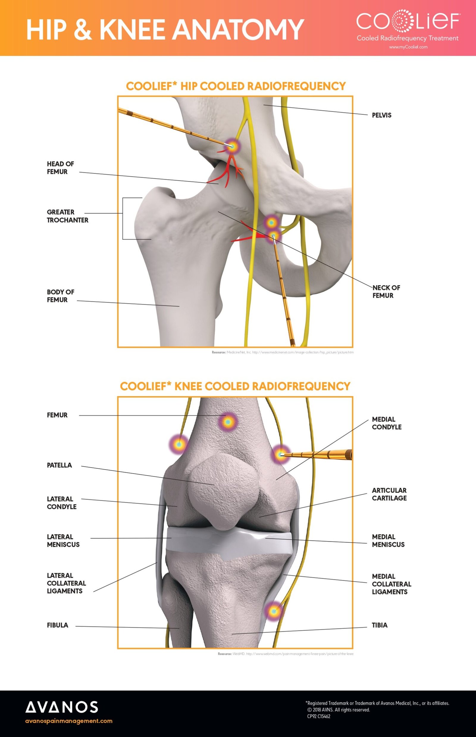 C15462 COOLIEF Hip and Knee Anatomy Poster – Avanos_page-0001