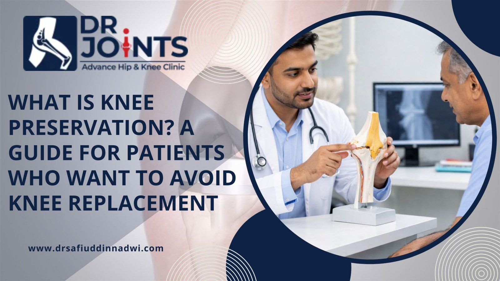 What Is Knee Preservation? A Guide for Patients Who Want to Avoid Knee Replacement