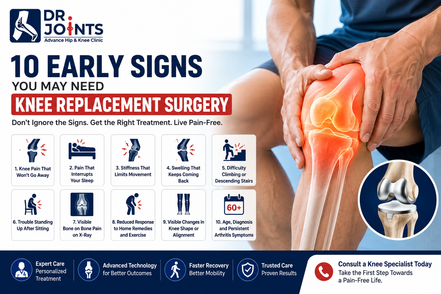 10 Early Signs You May Need Knee Replacement Surgery